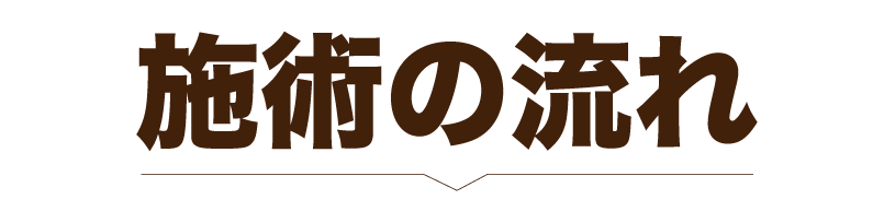 施術の流れ